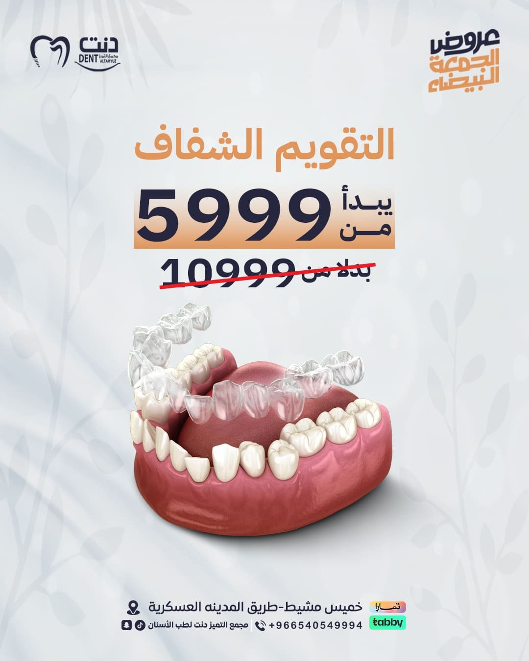 التقويم الشفاف