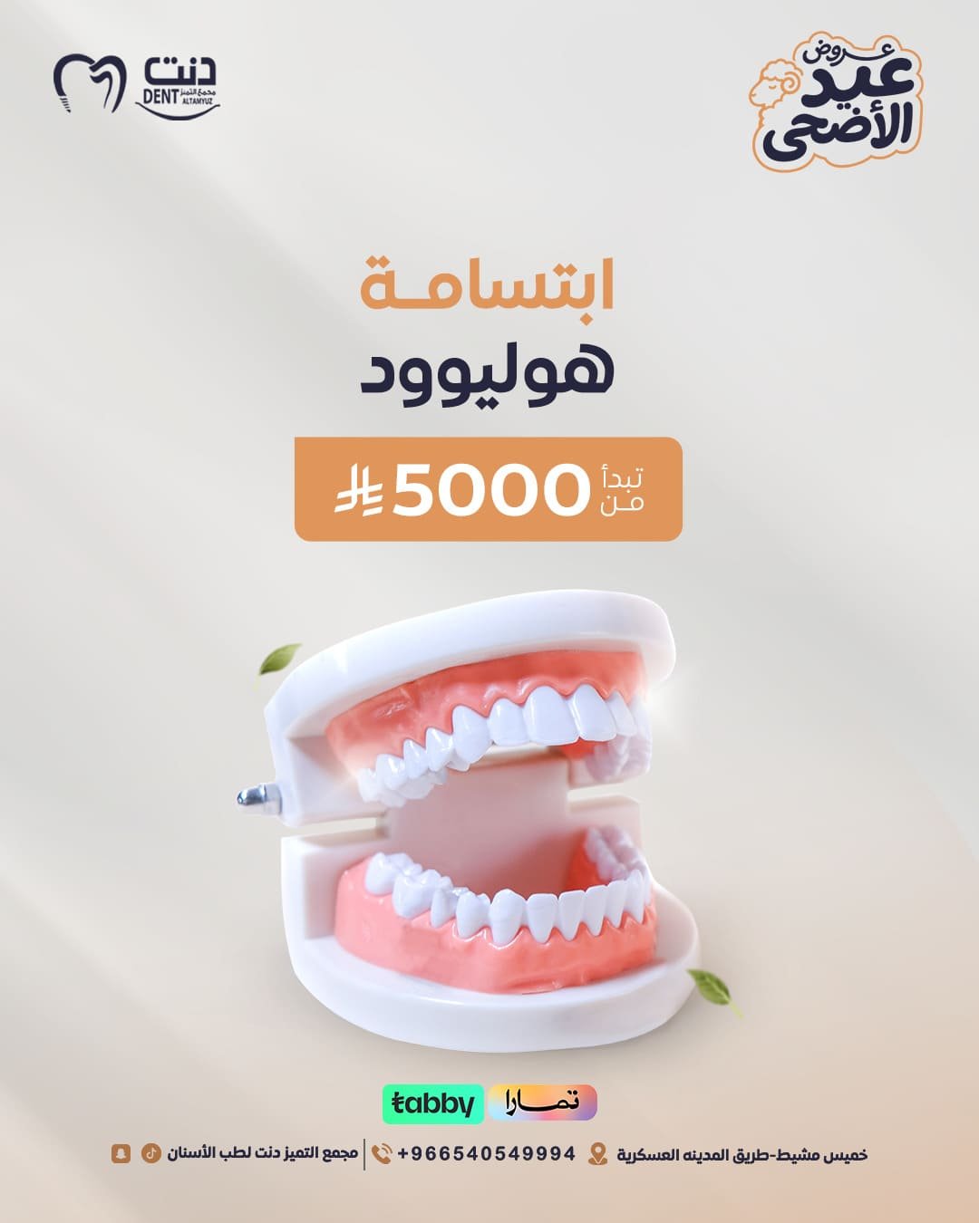 ابتسامة هوليوود