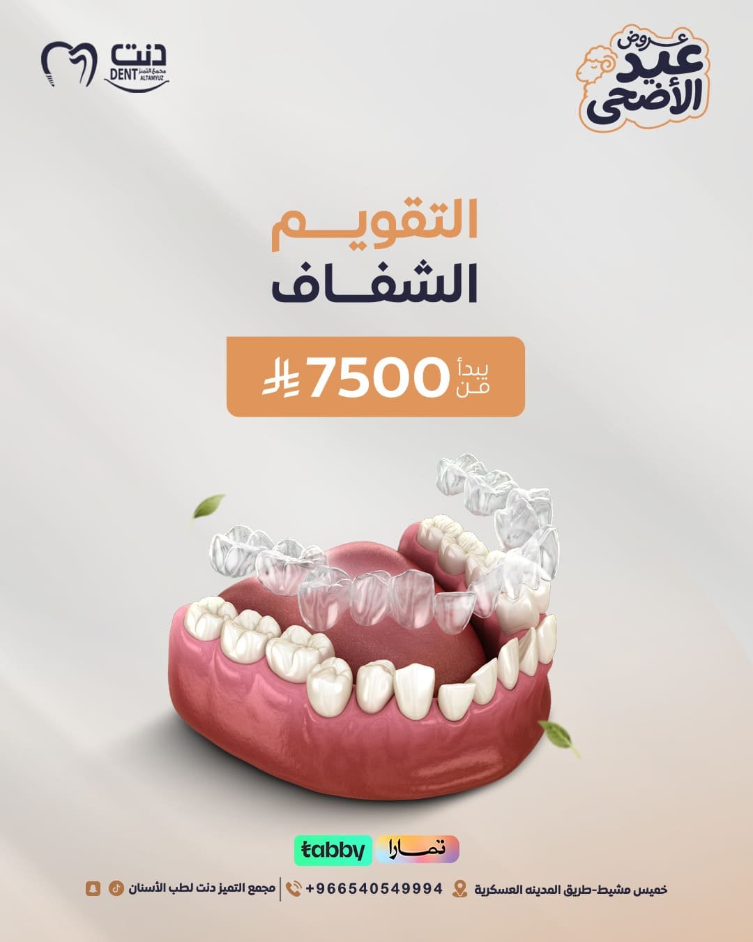 التقويم الشفاف
