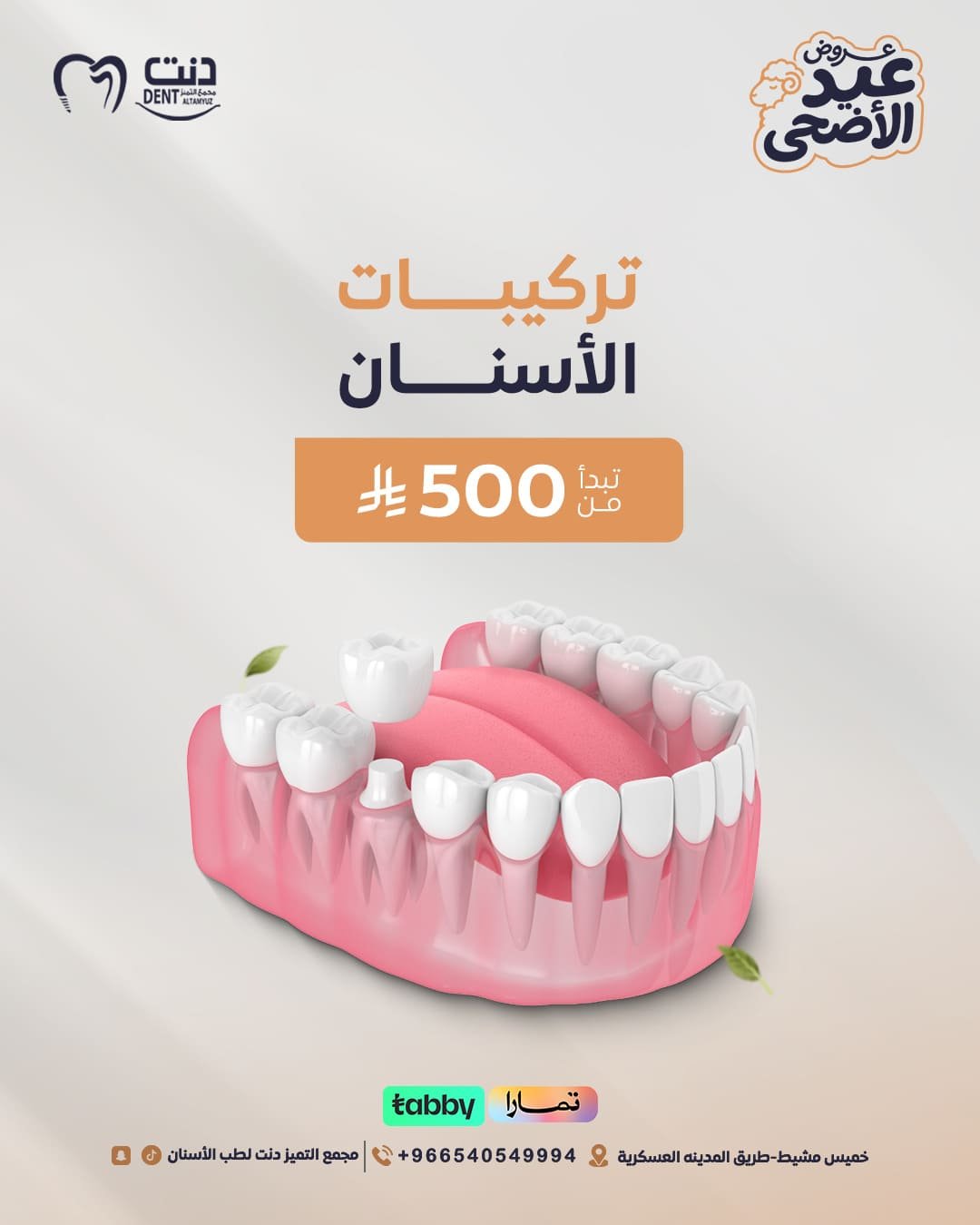 تركيبات الأسنان
