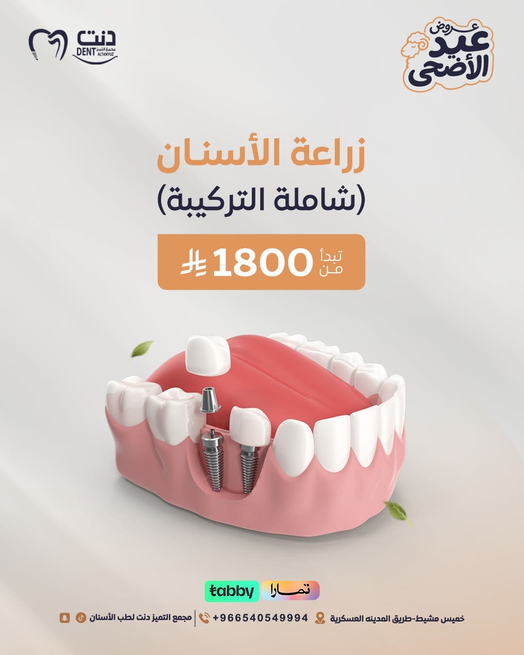 زراعة الأسنـان