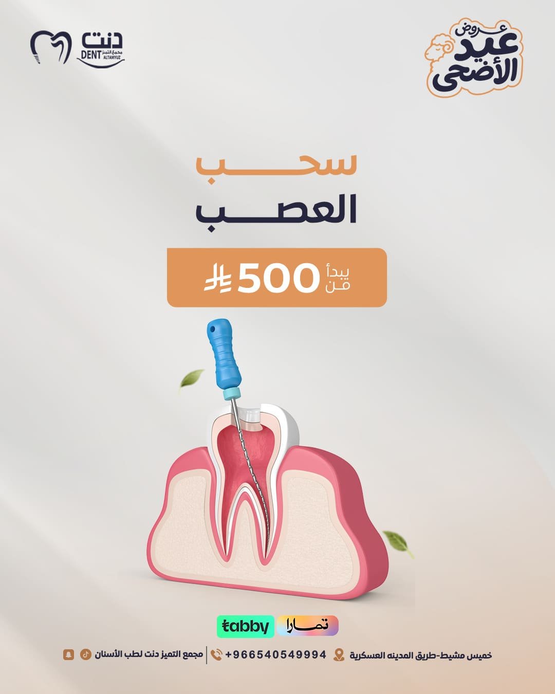 سحب العصب