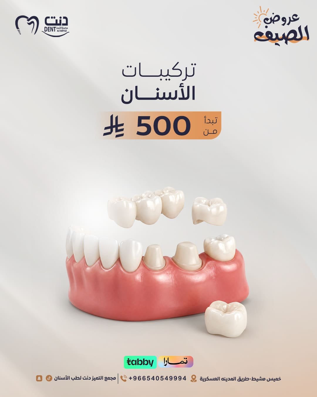 تركيبات الأسنان