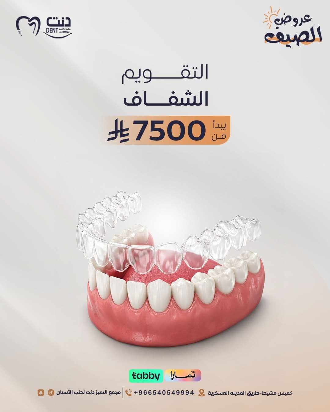 تقويم شفاف