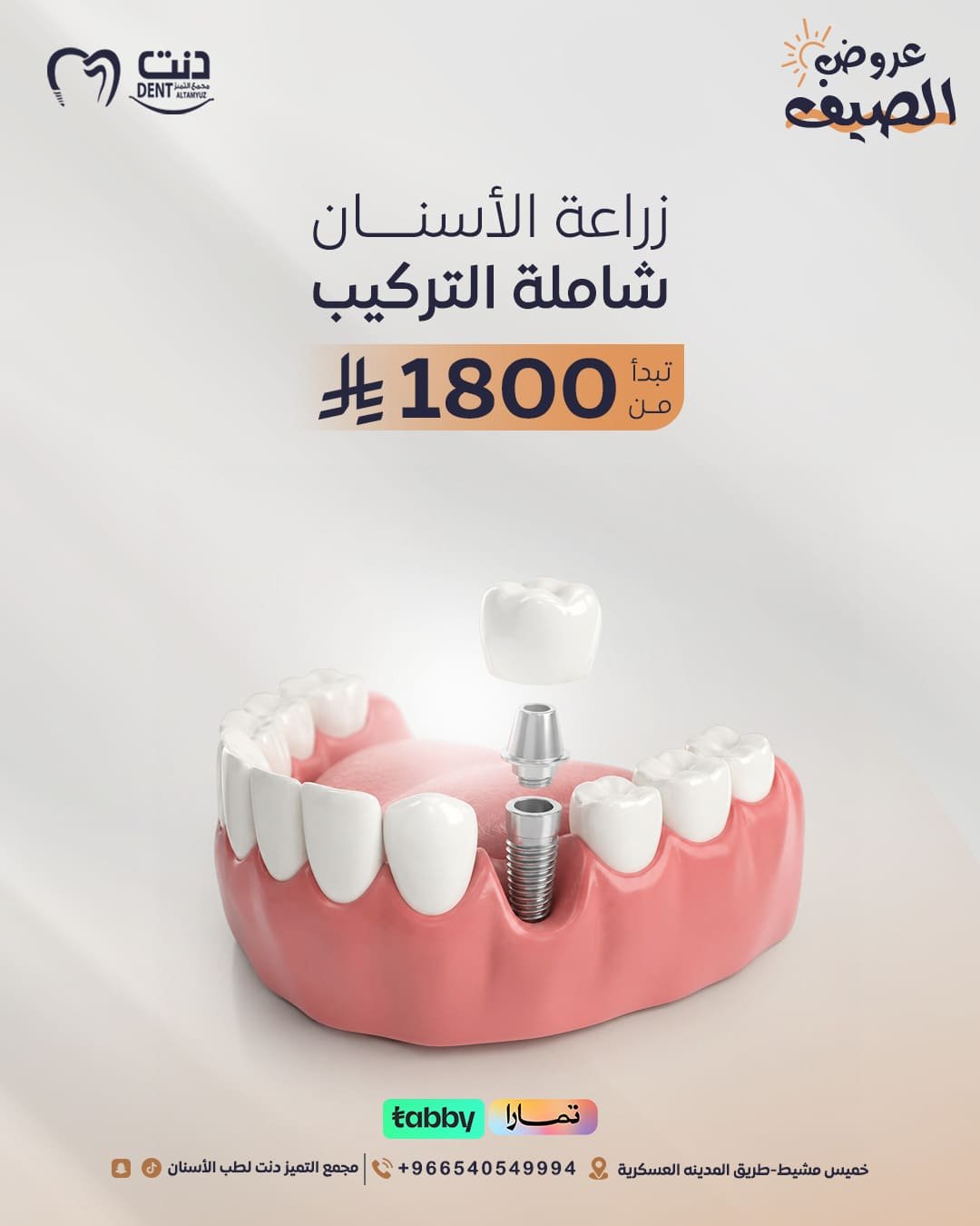 زراعة الأسنــــان