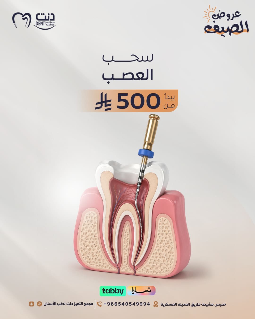 سحـــــب العصــب